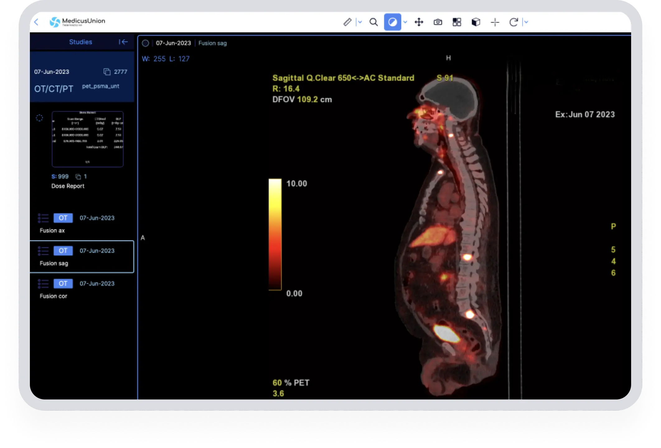 Access your medical records easily with MedicusUnion's DICOM Viewer.